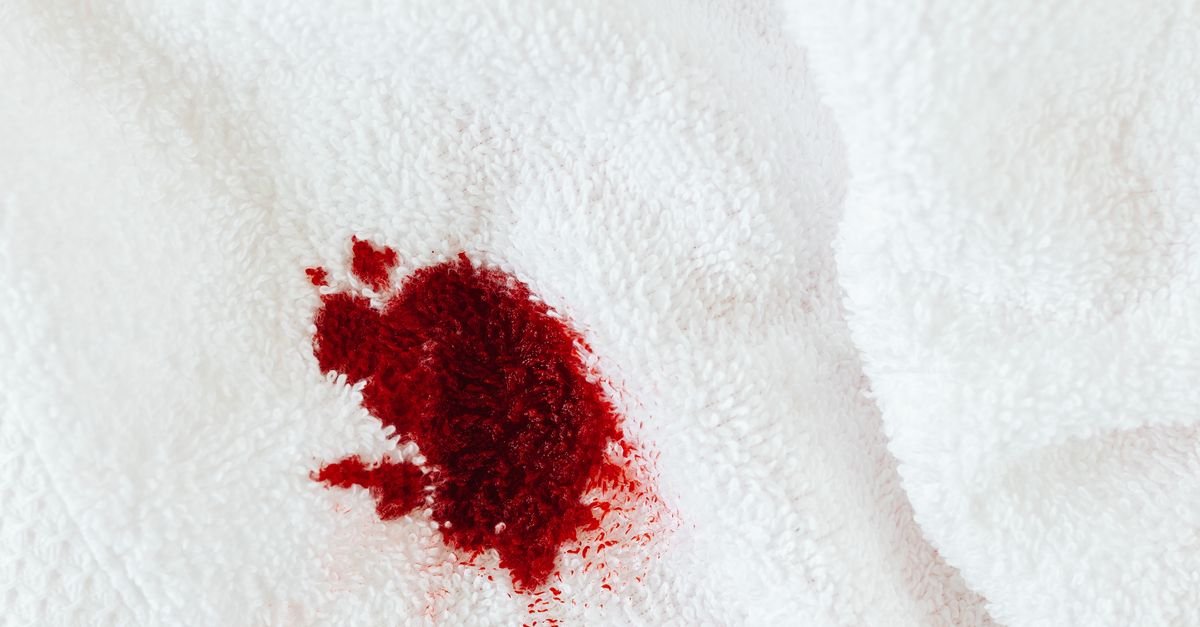 Remove Stains